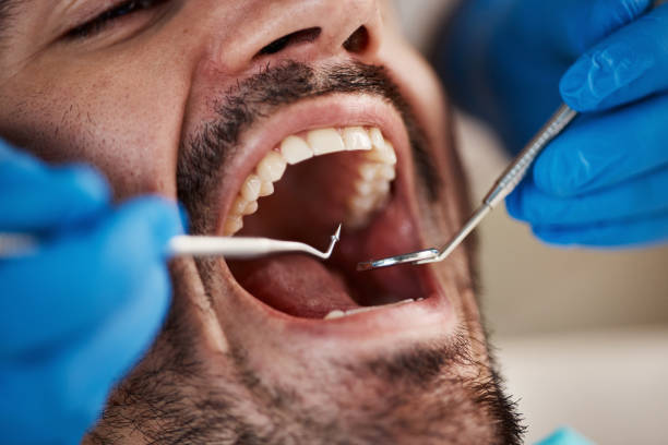 Best Emergency Treatment for Jaw Pain or Injury in Holbrook, NY